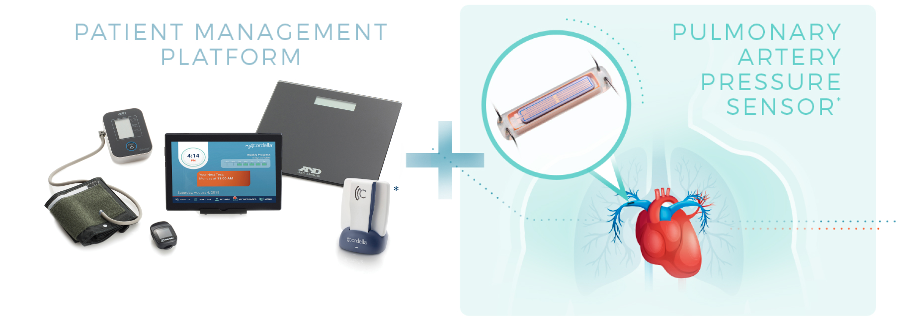 Cordella System for Hemodynamic Monitoring - Endotronix Endotronix